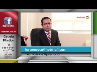 012 QUE TECNICAS HAY PARA REALIZAR UNA LIPOSUCCION