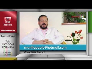 ¿Cuál es el tratamiento oportuno para la parálisis facial?