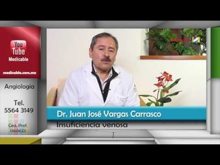 ¿Quién está en riesgo de desarrollar insuficiencia venosa?