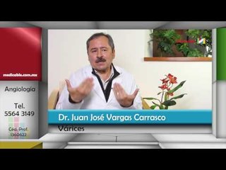 ¿Cómo se afecta la calidad de vida de quienes padecen várices?