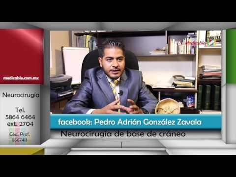 003 CUALES SON LAS LESIONES CRANEO ENCEFALICAS QUE SE PUEDEN TRATAR CON NEUROCIRUGIA DE BASE DE CRAN