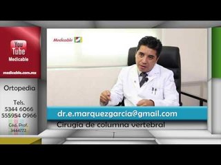 010 COMO SE REALIZZA UNA CIRUGIA DE COLUMNA VERTEBRAL ASISTIDA POR COMPUTADORA