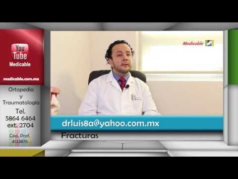 014 COMO SE PUEDEN PREVENIR LAS FRACTURAS