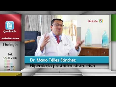 ¿Se puede prevenir la hiperplasia prostática obstructiva?