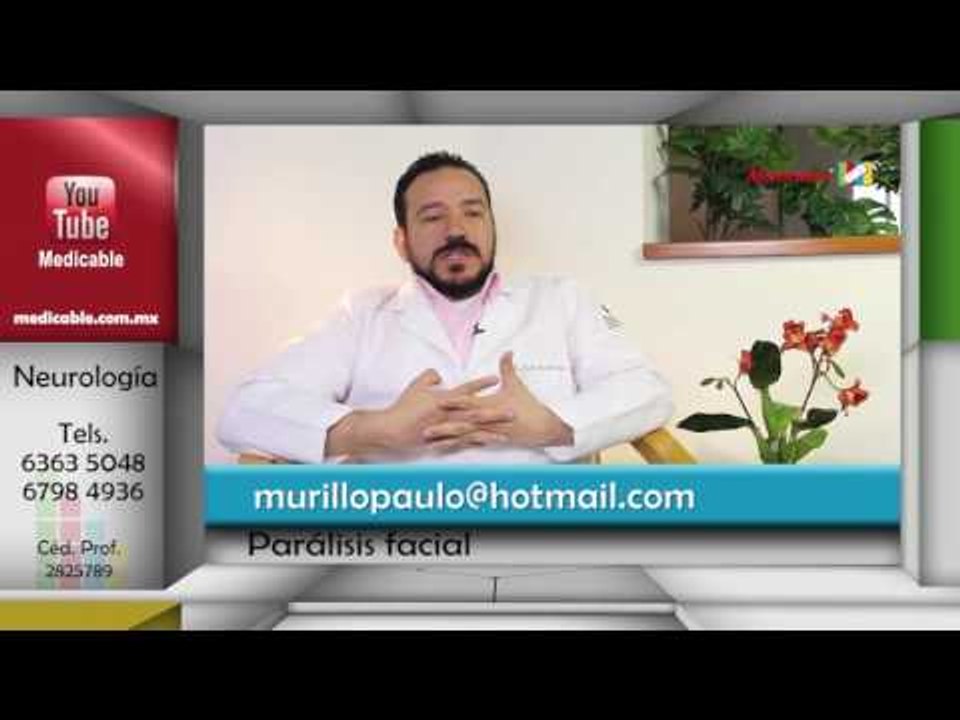 ¿Existen síntomas previos a una parálisis facial?