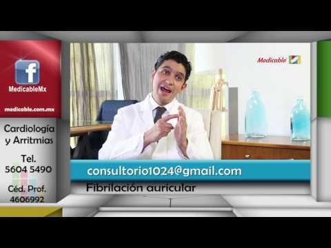 ¿Cuáles son las opciones de tratamiento para la fibrilación auricular?