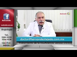 ¿Cómo se trata la insuficiencia venosa crónica?