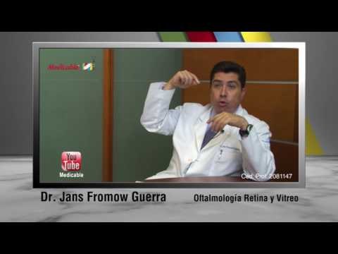 Las manchas flotantes y centellos en el ojo, ¿son síntomas de un desprendimiento de retina?