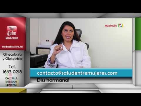 ¿Cuáles son los efectos secundarios del DIU hormonal?