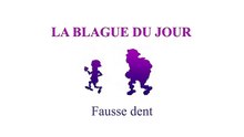 Fausse dent - La blague du jour