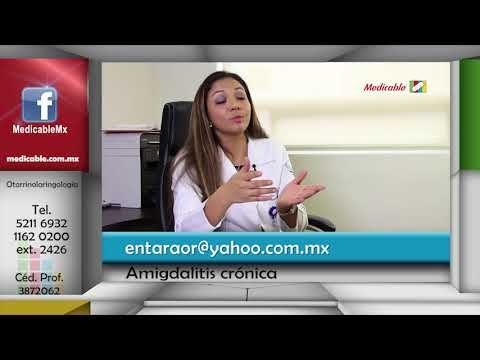 ¿Cuáles son las complicaciones de la amigdalitis crónica?