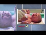 APNEA NEONATAL RESPIRATORIA