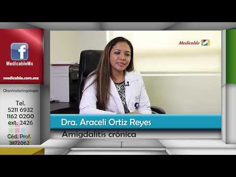 ¿Qué tratamientos existen para la amigdalitis crónica?