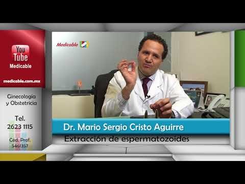 ¿Se pueden extraer espermas directamente de los testículos?