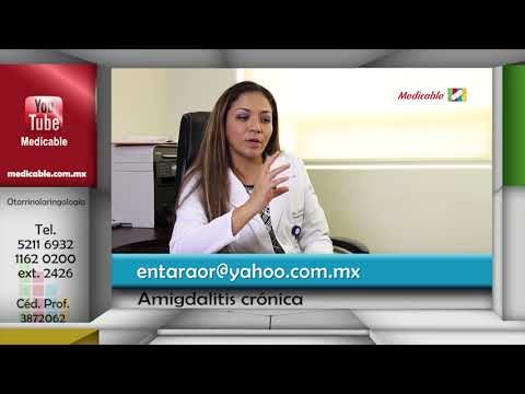 ¿Cómo se diagnostica la amigdalitis crónica?