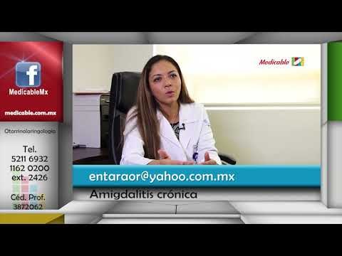 Recomendaciones después de una cirugía de amigdalitis crónica.