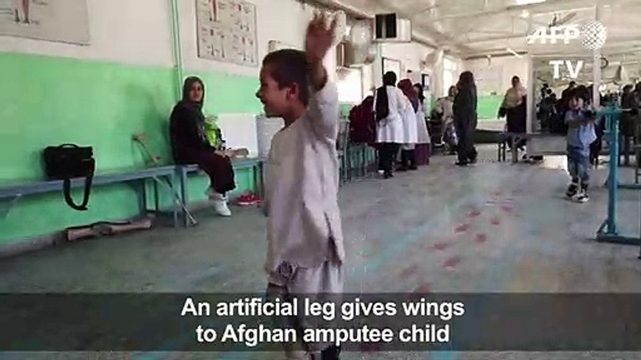 Young Afghan amputee dances on new leg