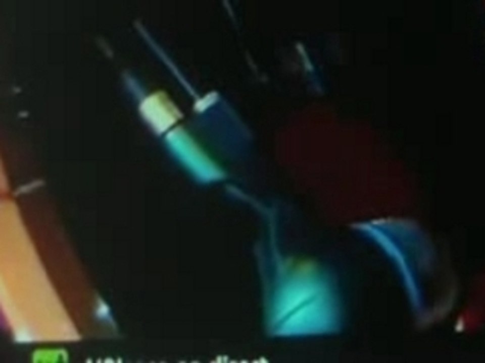 billy briliantinne and the kustom killers a la télé