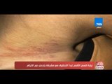 مصر فى اسبوع - بالفيديو| حقيقية تعذيب أيتام دار  