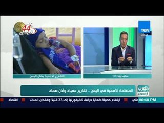 الحكومة اليمنية ترد علي التقارير الأممية بشأن حقوق الإنسان