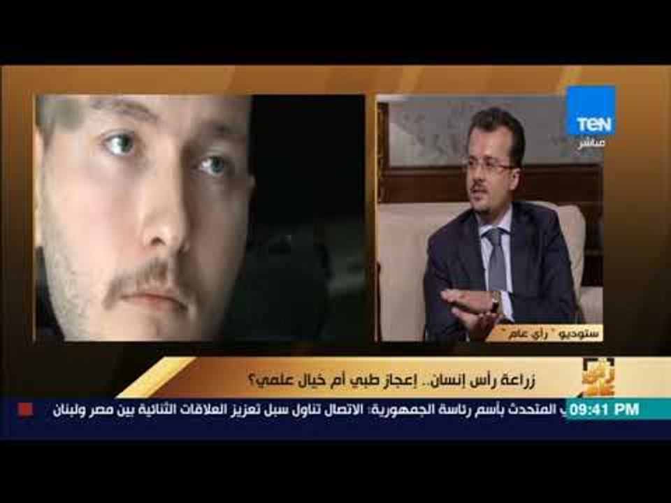 رأى عام - زراعة رأس إنسان.. إعجاز طبي أم خيال علمي؟
