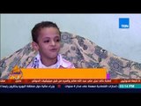 عسل أبيض - طفل يجري 33 عملية جراحية للتحول الجنسي