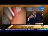 رأى عام - لماذا لم تصدر الصحة تراخيص لمراكز العلاج بالخلايا الجذعية .. تعرف على السبب