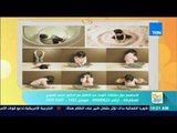 صباح الورد - محمد المهدي أستاذ الطب النفسي يوضح علامات التوحد على الطفل