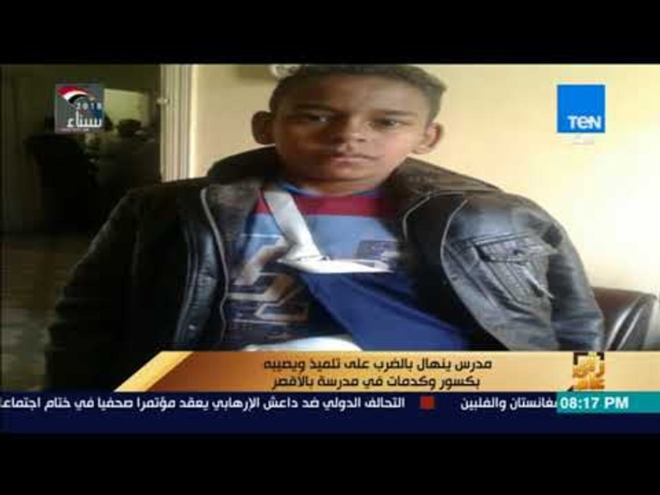 رأي عام - مدرس ينهال بالضرب على تلميذ ويصيبه بكسور وكدمات في مدرسة بالأقصر