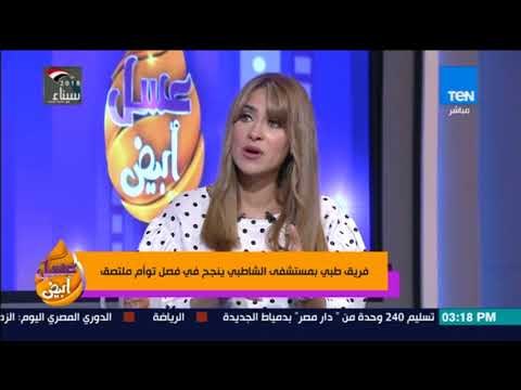 عسل أبيض - فريق طبي بمستشفى الشاطبي ينجح في فصل توأم ملتصق