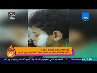 عسل أبيض - تلميذ "يشوه" وجه زميله بـ "موس"..  ووالدته تستغيث بوزير التعليم