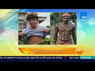 صباح الورد - سفاح الفات.. كيف تخسر وزنك ببساطة؟