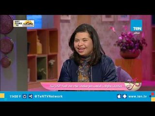 بطلة العالم لذوي القدرات الخاصة في الكارتيه "لـ تامر حسني ويسرا": نفسي اشوفكم وأتصور معاكم