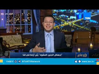 إجهاض الجنين المشوة" .. يثير ضجة بقنا