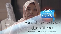 بعد معاناتها لسنوات من شكل أسنانها.. شاهد كيف تغيرت المغربية نعيمة بعد التجميل