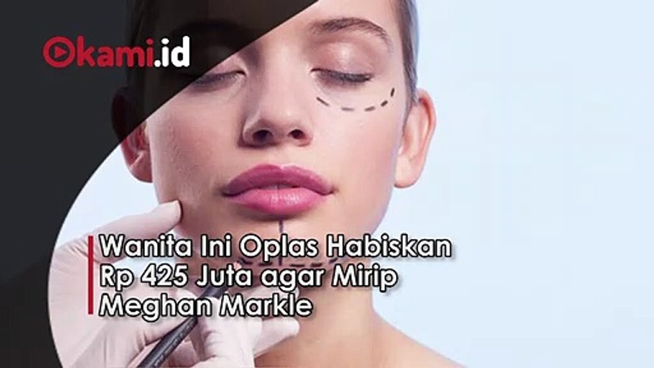 Wanita Ini Oplas Habiskan Rp 425 Juta agar Mirip Meghan Markle