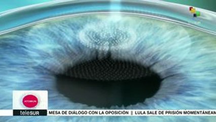 Atomun: La tecnología al servicio de la oftalmología