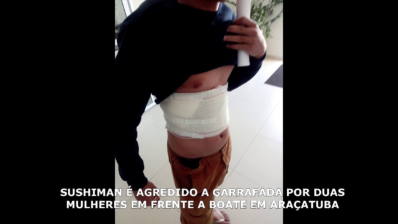 Sushiman é agredido a garrafada por duas mulheres e recebe ameaça de morte por whtsapp
