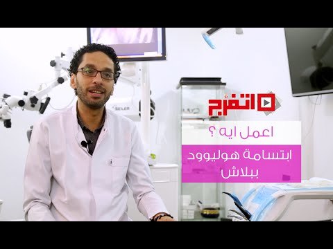 اتفرج A3ml A - اعمل ايه | إبتسامة هوليوود .. ببلاش