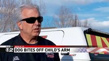 Four-Year-Old's Arm Bitten Off By Neighbor's Husky