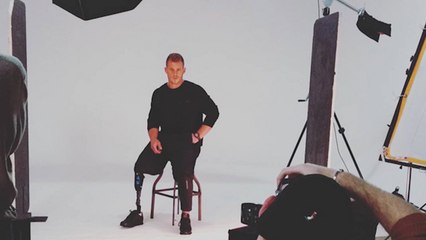 Model With One Leg Becomes Catwalk Star