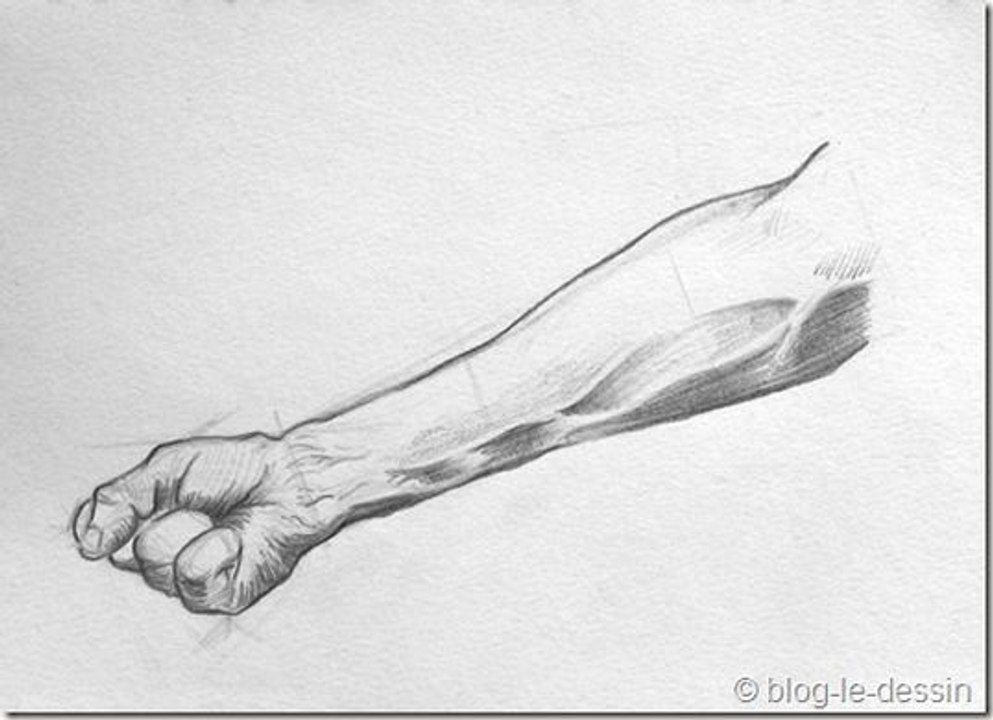 Suicide by Self Harm