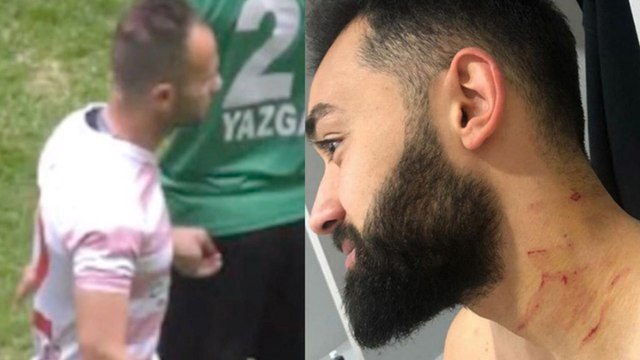 Turkish Soccer Player SLASHED Opponents With A RAZOR BLADE in ATTACK During Game!
