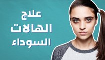 علاج الهالات السوداء