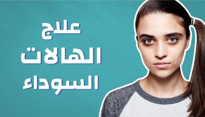 علاج الهالات السوداء