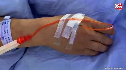 Hối hận vì đánh vợ, người đàn ông tự dùng dao chặt đứt 4 ngón tay