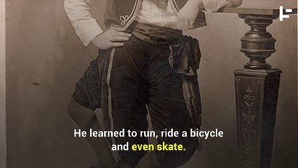 The Astonishing Story of The Three- Legged Man