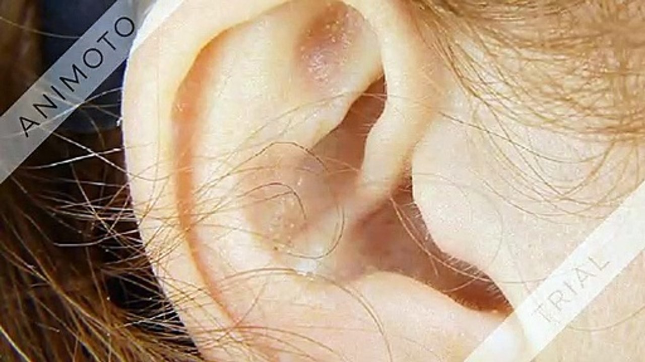 Tinnitec - Your Ear Must Be Strong