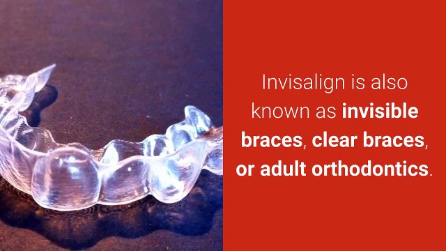 Invisalign Fishers | 3175968000 | fallcreekdentistry.com