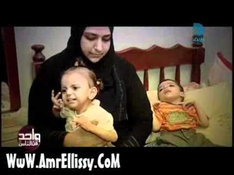واحد من الناس - عمرو الليثي والحالات الانسانية - الطفلين احمد ونور واصابتهما بمرض نادر